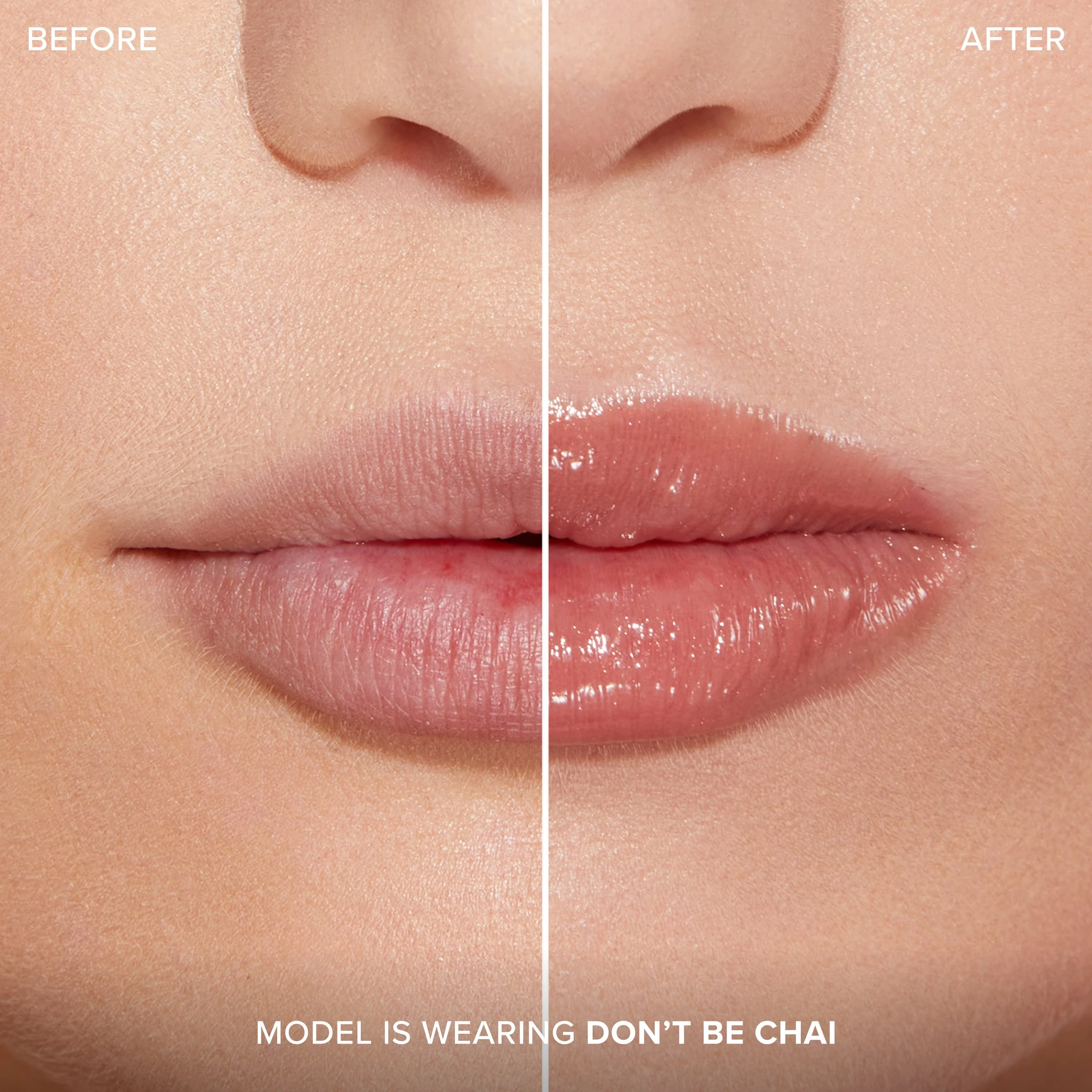Lip Injection Extreme Plumping ClicksLip Injection Extreme Plumping Clicks 4 Lip Injection Extreme Plumping ClicksLip Injection Extreme Plumping Clicks