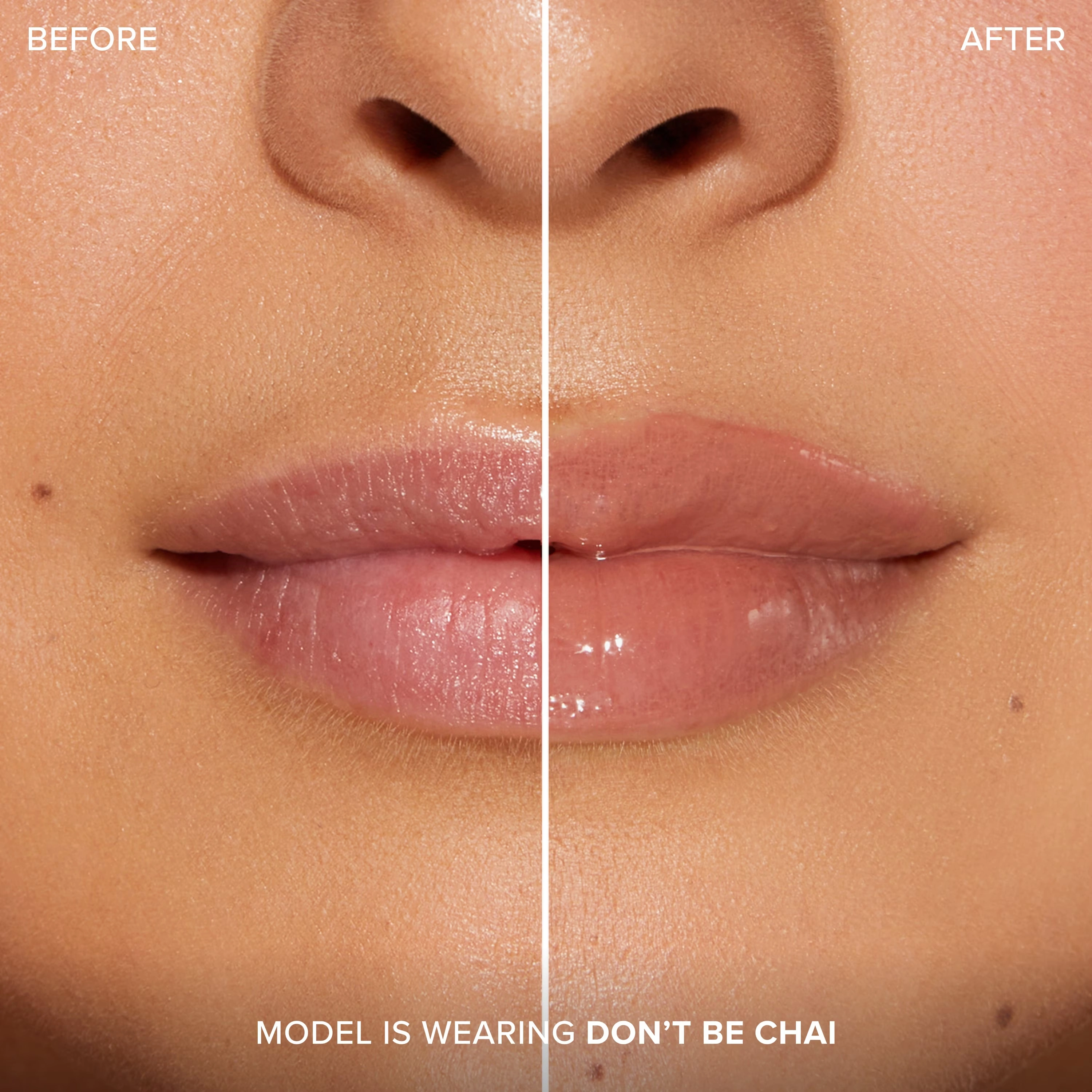 Lip Injection Extreme Plumping ClicksLip Injection Extreme Plumping Clicks 8 Lip Injection Extreme Plumping ClicksLip Injection Extreme Plumping Clicks