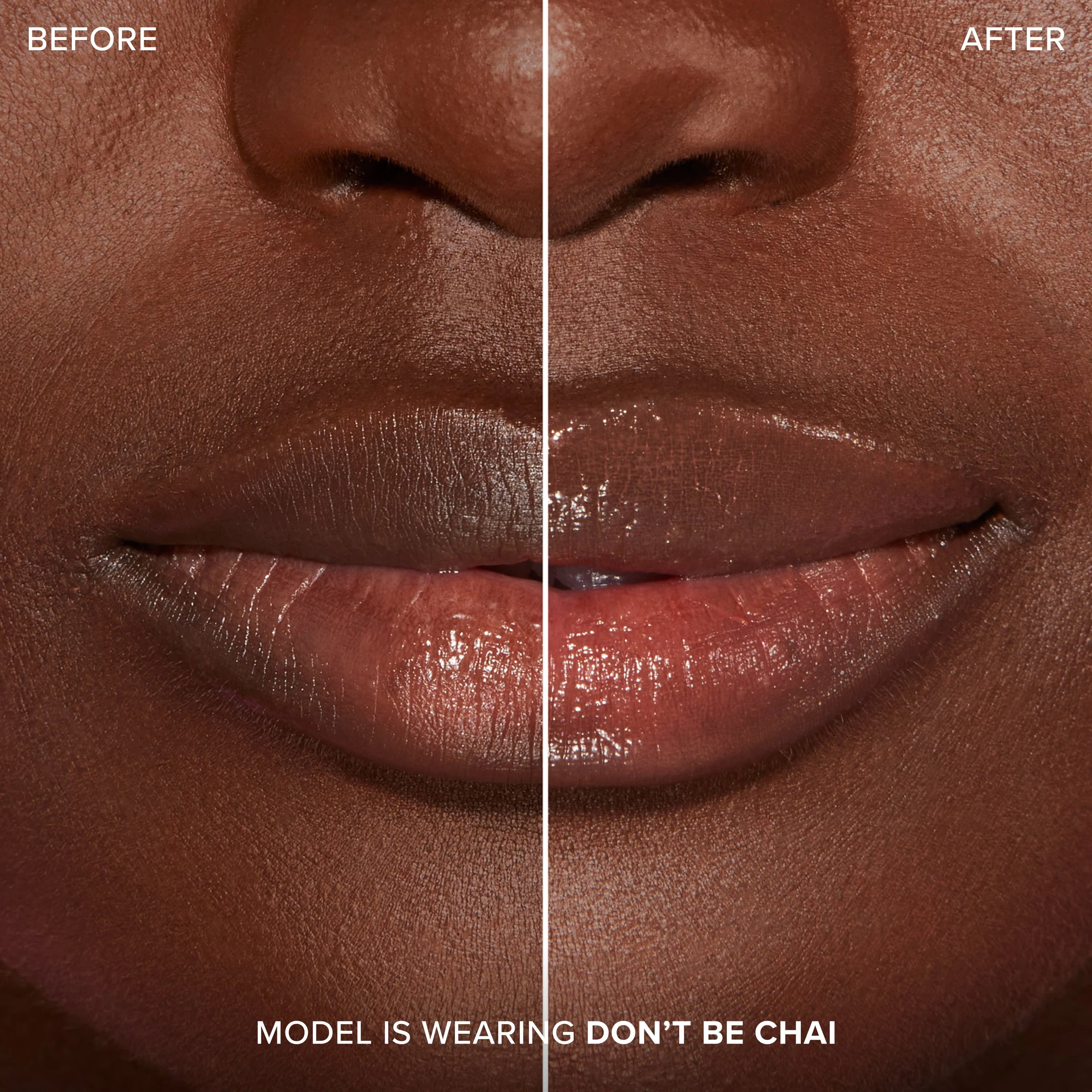 Lip Injection Extreme Plumping ClicksLip Injection Extreme Plumping Clicks 9 Lip Injection Extreme Plumping ClicksLip Injection Extreme Plumping Clicks