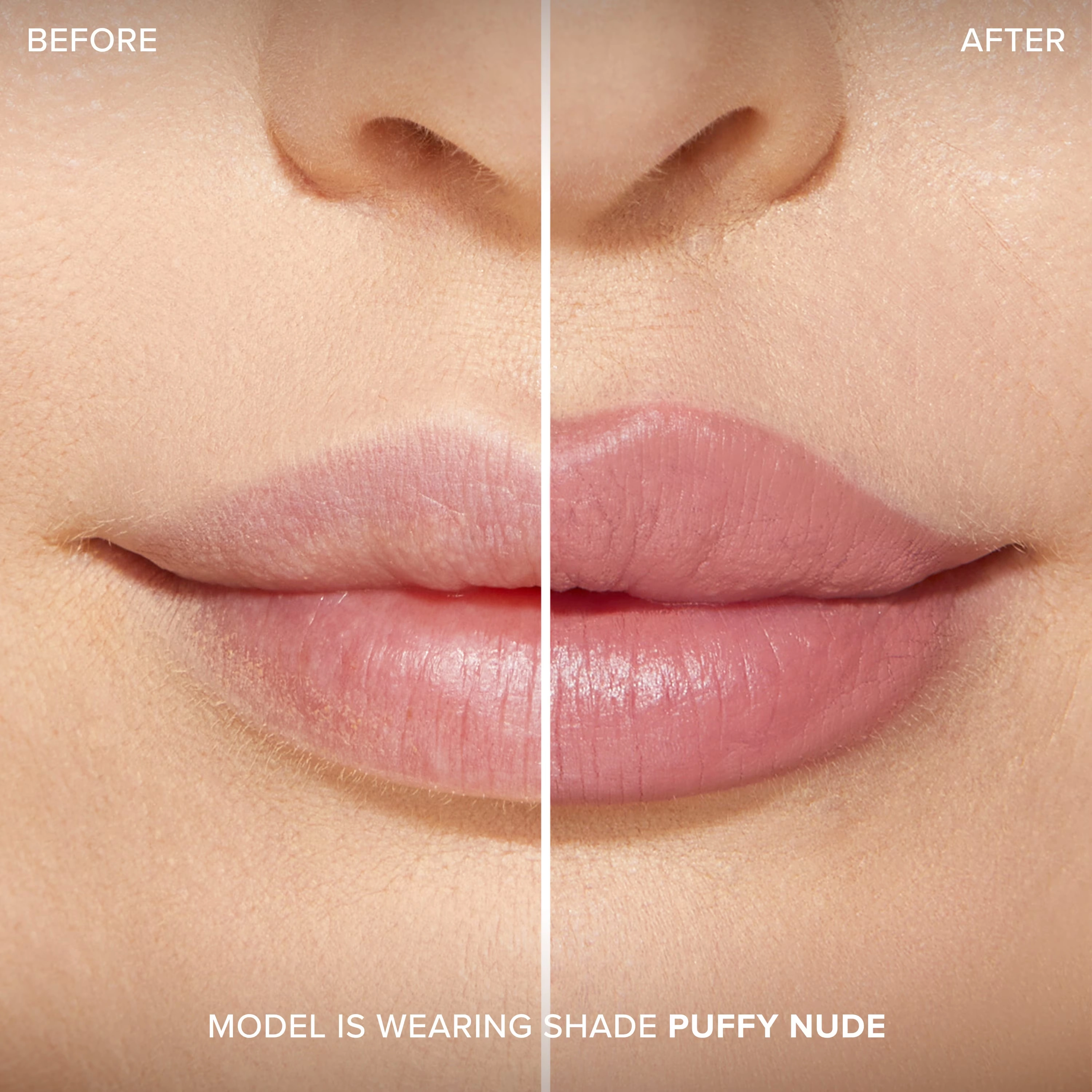 Lip Injection Extreme Lip ShaperLip Injection Extreme Lip Shaper Beta