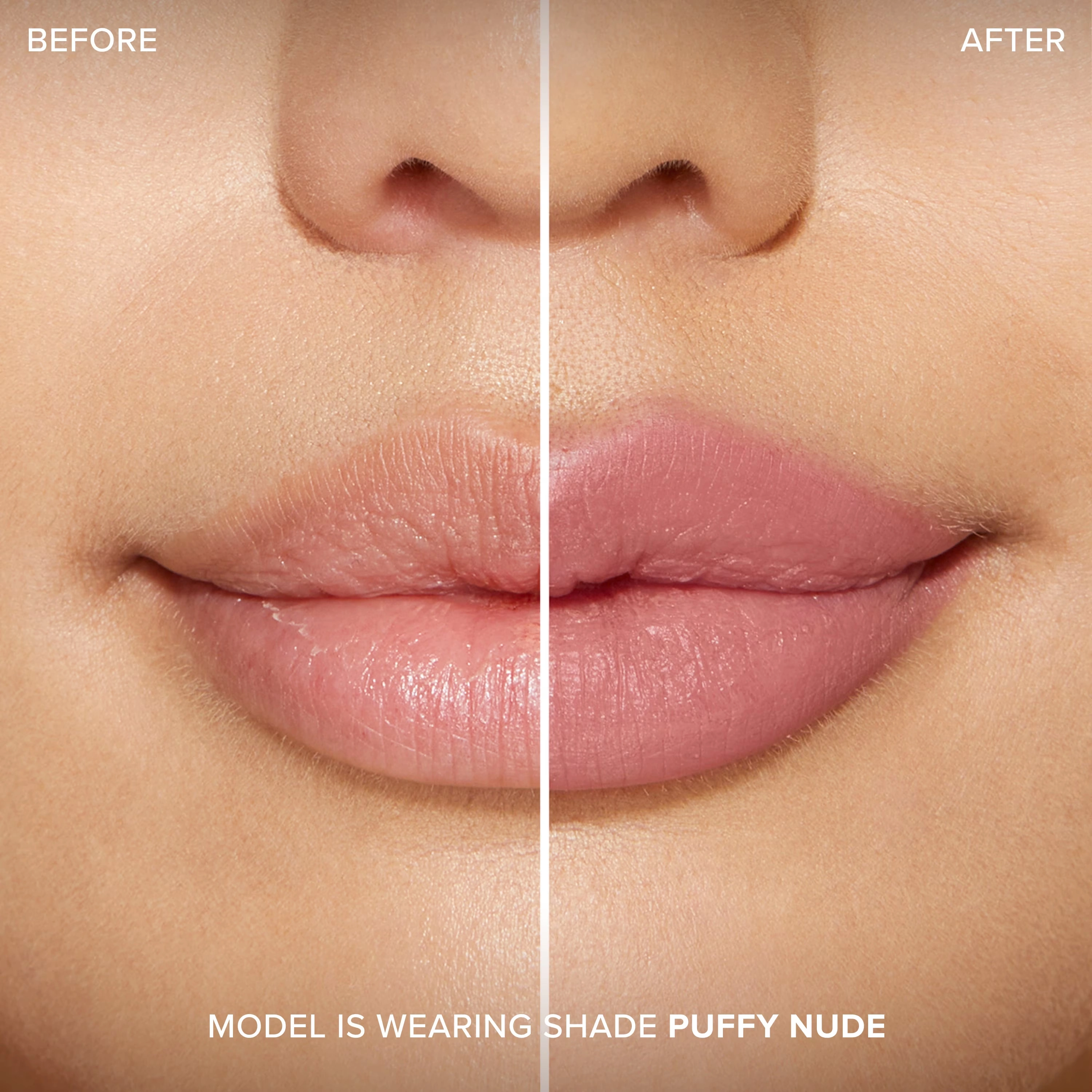 Lip Injection Extreme Lip ShaperLip Injection Extreme Lip Shaper Beta